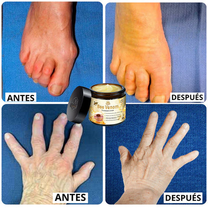 🐝Bee Venom Bswell - Crema Para Dolores con Veneno de Abeja